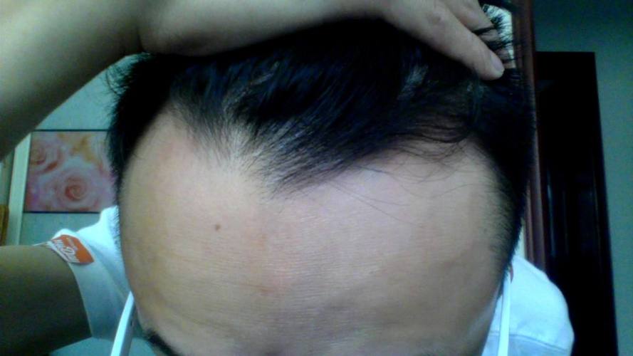 <font color='red'>额头</font>右边有旋命运 <font color='red'>额头</font>右侧有旋有什么说法