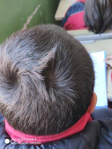 <font color='red'>头顶</font>两个旋算命男孩 易经对男孩双旋的解释